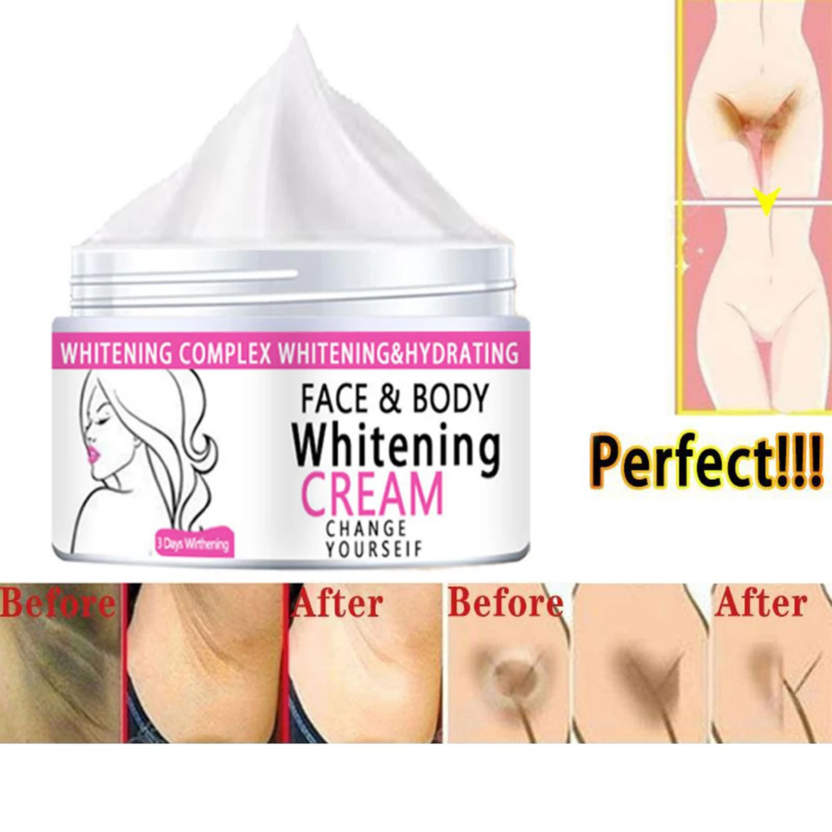 

Body Whitening Cream Underarm Armpit Knee Dark Skin Whitening Bleaching Cream Moisturizing Brighten Body Lotion For Women Men