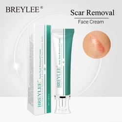 BREYLEE Acne Scar Removal Cream 30g Face Cream Skin Repair Skin Care Scar Acne Treatment Remove Stretch Marks Whitening Cream