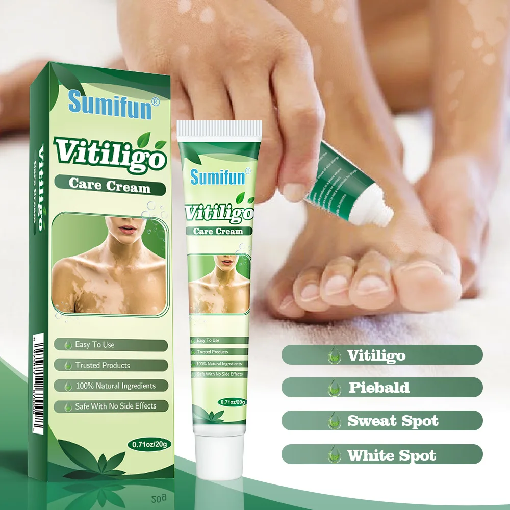 10Pcs Sumifun Vitiligo Repair Cream White Spot Disease Treatment Ointment Localized Leukoplakia Nourishing Skin Chiense Medicine