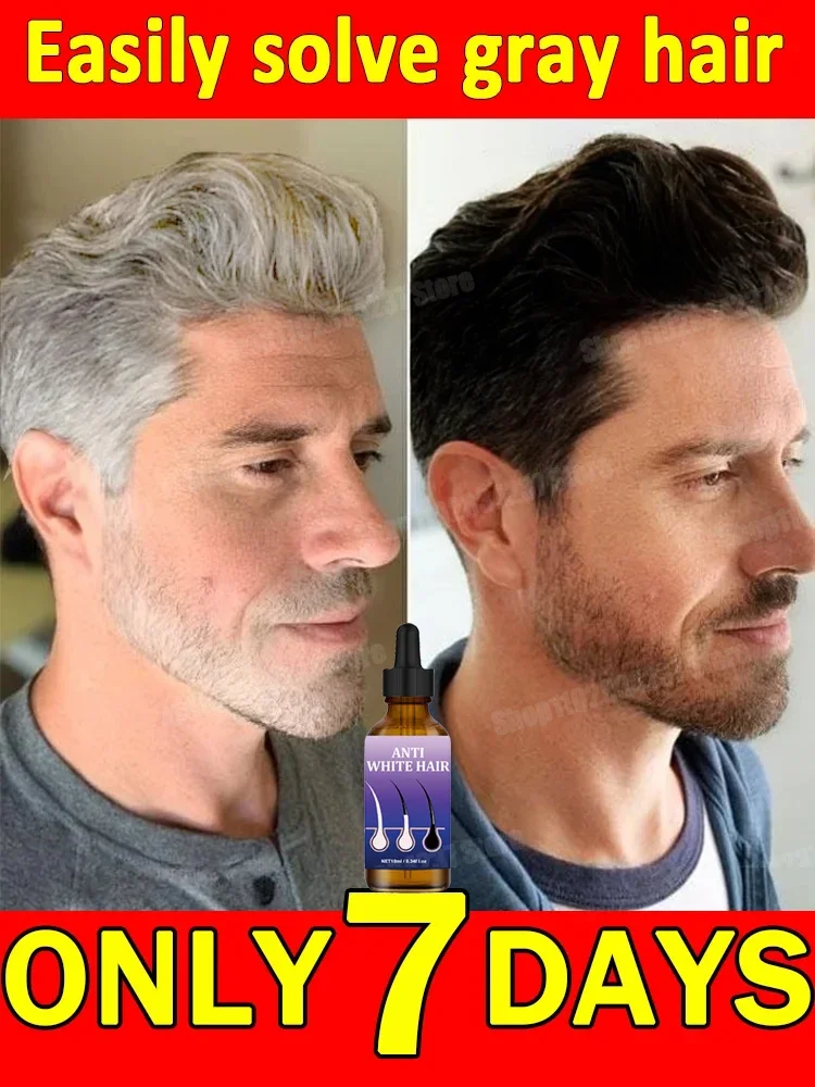 Hair Care White To Black Anti-gray Hair Natural Color Repair Nourish Essence for Men Women Hair Loss Product