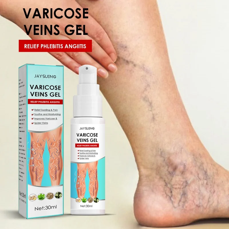 Feet Varicose Veins Cream Treatment Gel Relieve Dilated Capillaries Removal Phlebitis Spider Leg Veins Varicose Cream 30g