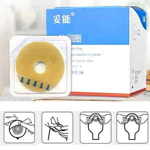 10Pcs Leak-proof Ostomy Paste Ring Baseplates Stoma Care Products For Ostomy Bag Stretch Shaping Prevent Leakage to Protect Skin