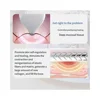 Pelvic Floor Muscle Trainer pelvic floor muscle stimulator  Kegel Exerciser Kegel Trainer For Bladder Support 5