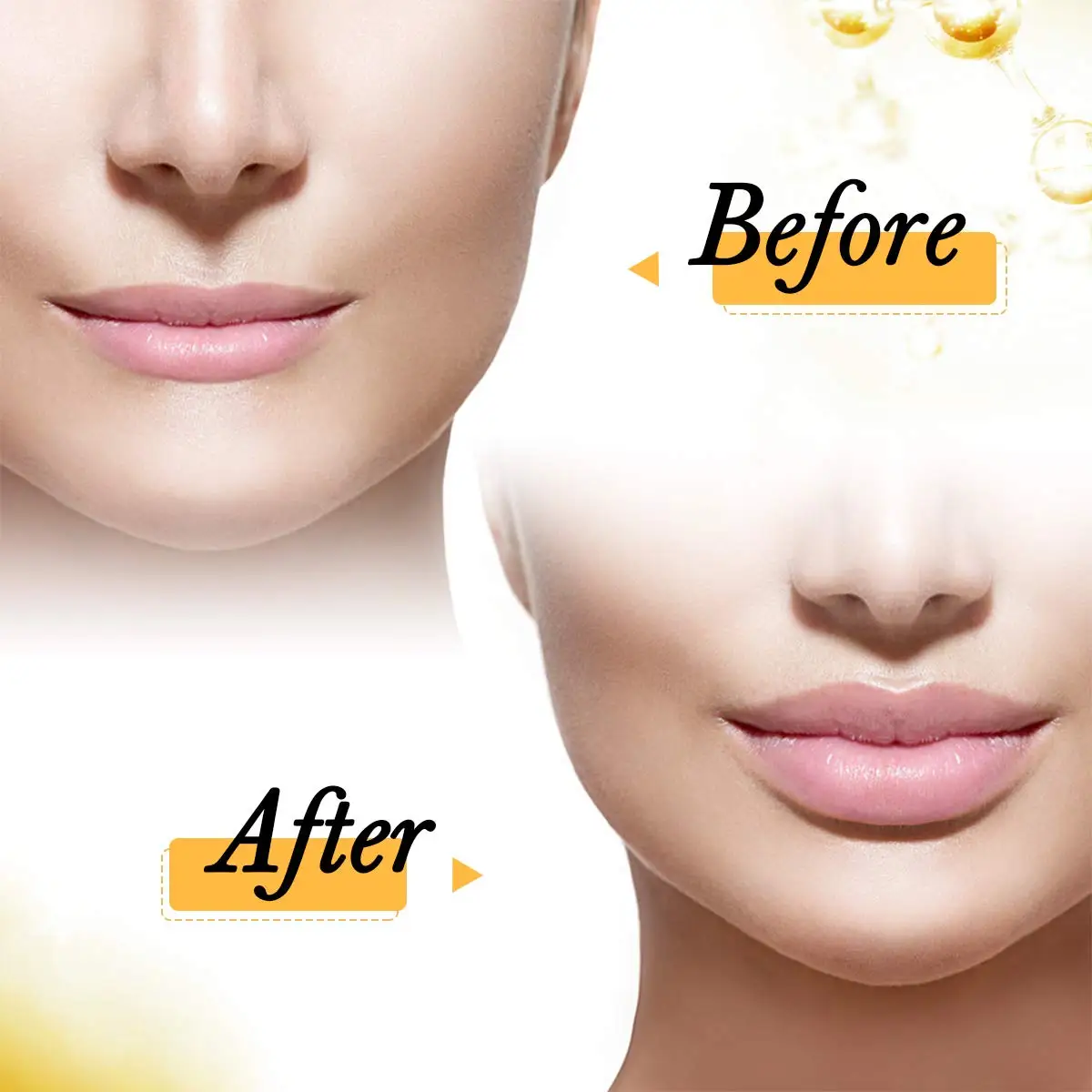 No-Needle Injection Gun, Hyaluron Pen, Face Skin Wrinkle Anti Aging, Ampuole Syringe 0.3ml Hyaluronic Acid Lip Filler Injectable