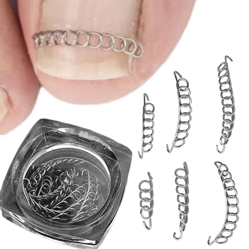 

12pcs Ingrown Toe Nail Correction Wire Fixer Silver Foot Pedicure Paronychia Recover Toenails Corrector Foot Care Tools Manicure