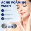Facial Cleanser Anti Acne Oil Control Blackhead Remover Shrink Pores Deep Cleansing Acne Treatment Moisturizing Face Wash 100g 3