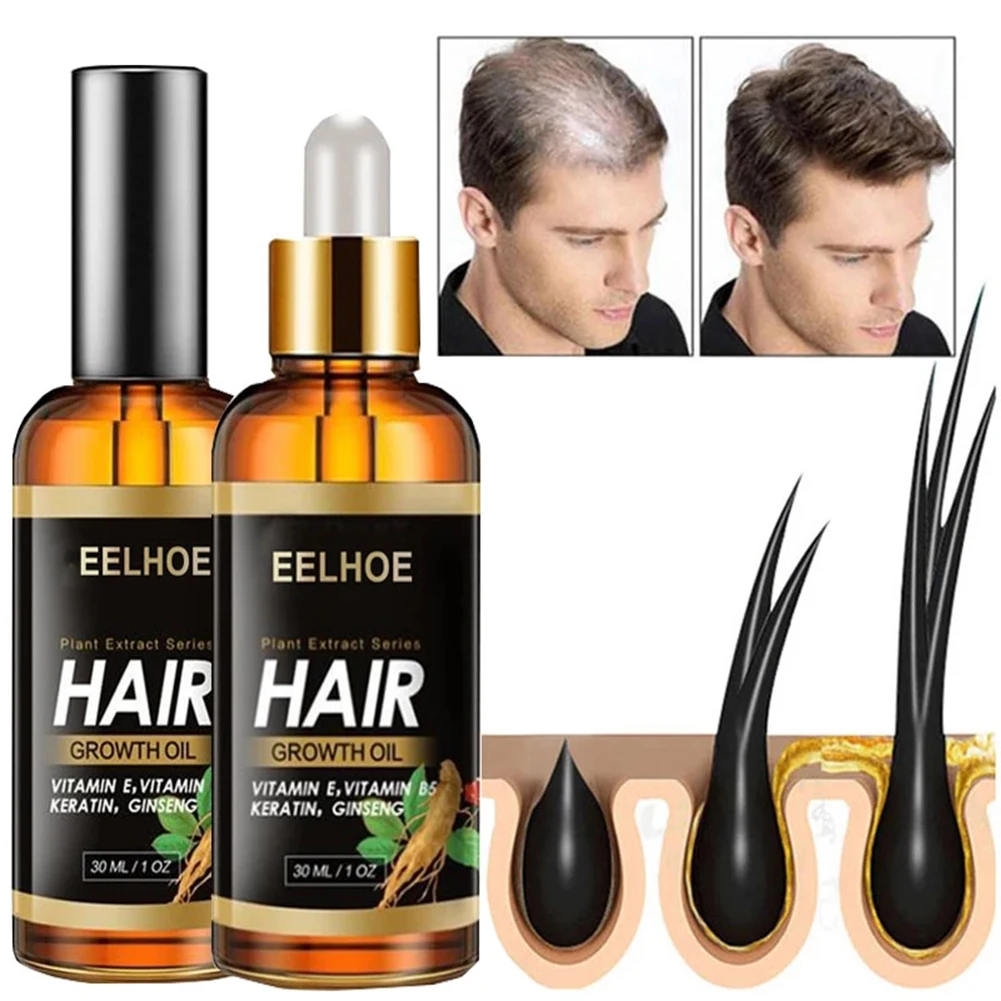 Hair Growth Serum Essential Oil Anti Hair Loss Spray Products Ginger For Treatment Dry Frizzy Damaged