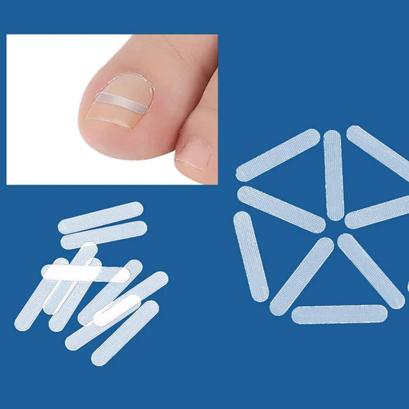 alt="A set of 10 Elastic Patch Stickers, an Ingrown Toe Nail Treatment and Pedicure Tool.