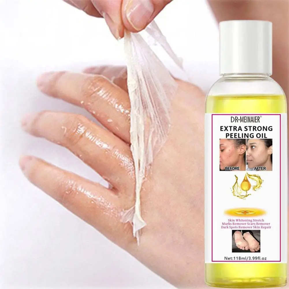 Yellow Peeling Oil Strong Yellow Peeling Oil Lighten Elbows Even Knees Tone Whiten And Skin Hands Skin X6J2