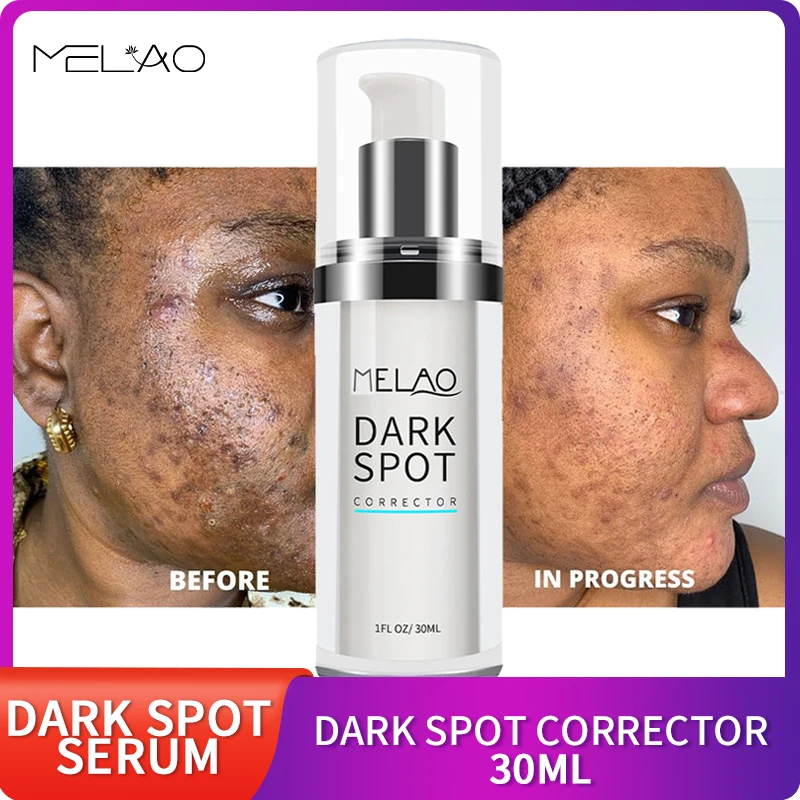 MELAO Dark Spot Corrector Serum Face 2