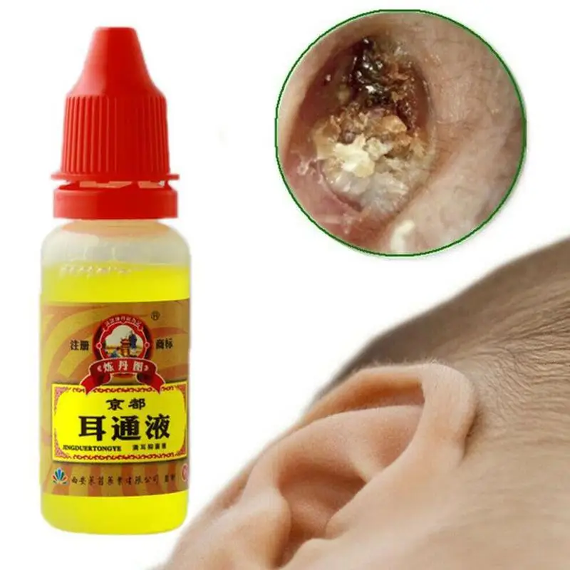 15ML Ear Acute Otitis Drops Chinese Herbal Medicine for Ear Tinnitus Deafness Sore Earwax