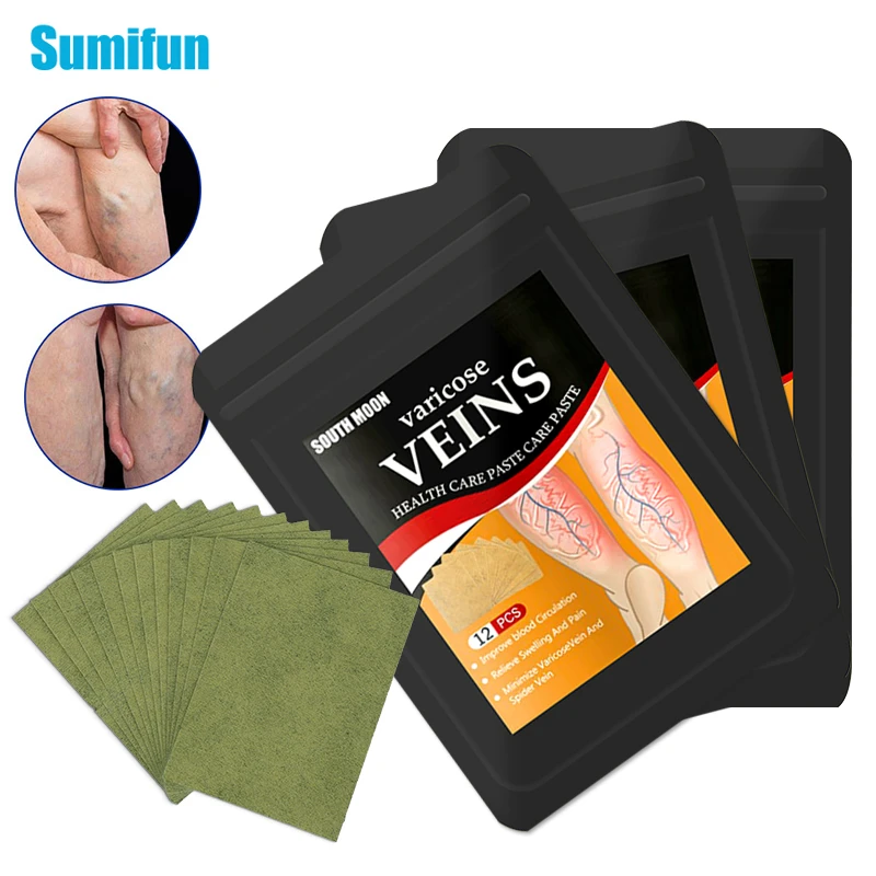 12Pcs/bag Varicose Veins Patch Remove Angiitis Dilated Vasculitis Spider Legs Chinese Medical Plaster Improves Blood Circulation pain relief patch blood sugar patch anti cough plaster urine leakage patch
