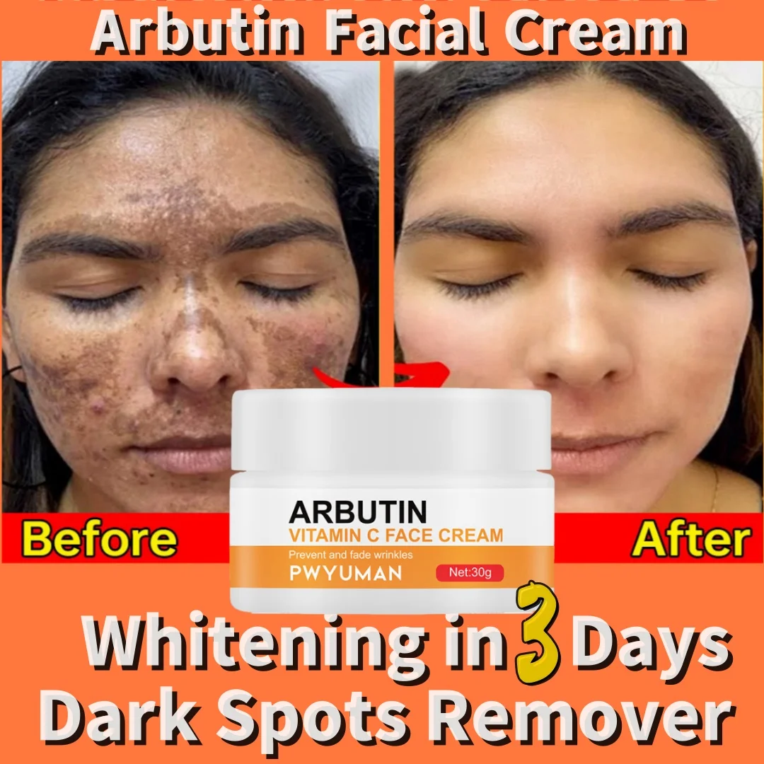 

Whitening Facial Cream Arbutin Fade Dark Spot Inhibit Melanin Vitamin C Firming Lifting Brightening Moisturizer Health Skin Care