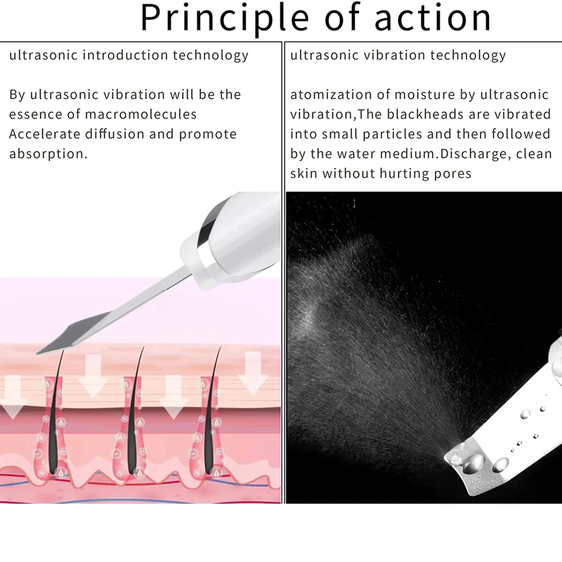 EMS Facial Body Radio Frequency Machine Skin Tightening Face Lifting RF Beauty Device Professional Home RF Skin Care Anti Aging