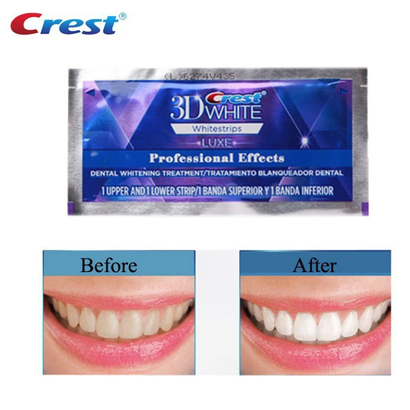 Crest 3D White Luxe Whitestrips Professional Effects Teeth Whitening 7 days teeth whitening strips