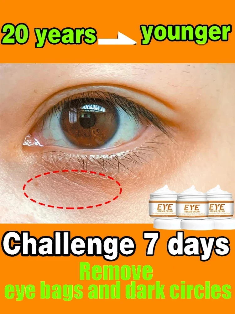 

Eye cream Remove bags Puffiness Dark Circles under eyes Lightening Fine Lines Moisturizing Whitening Skin Care