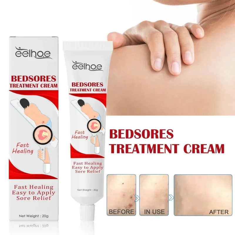 Decubitus Cream Pressure Sore Ulcer Skin Relief Ointment Bed Sore Wound Healing Treat Anti Dry Repair Moisturizing Body Care sore healing cream