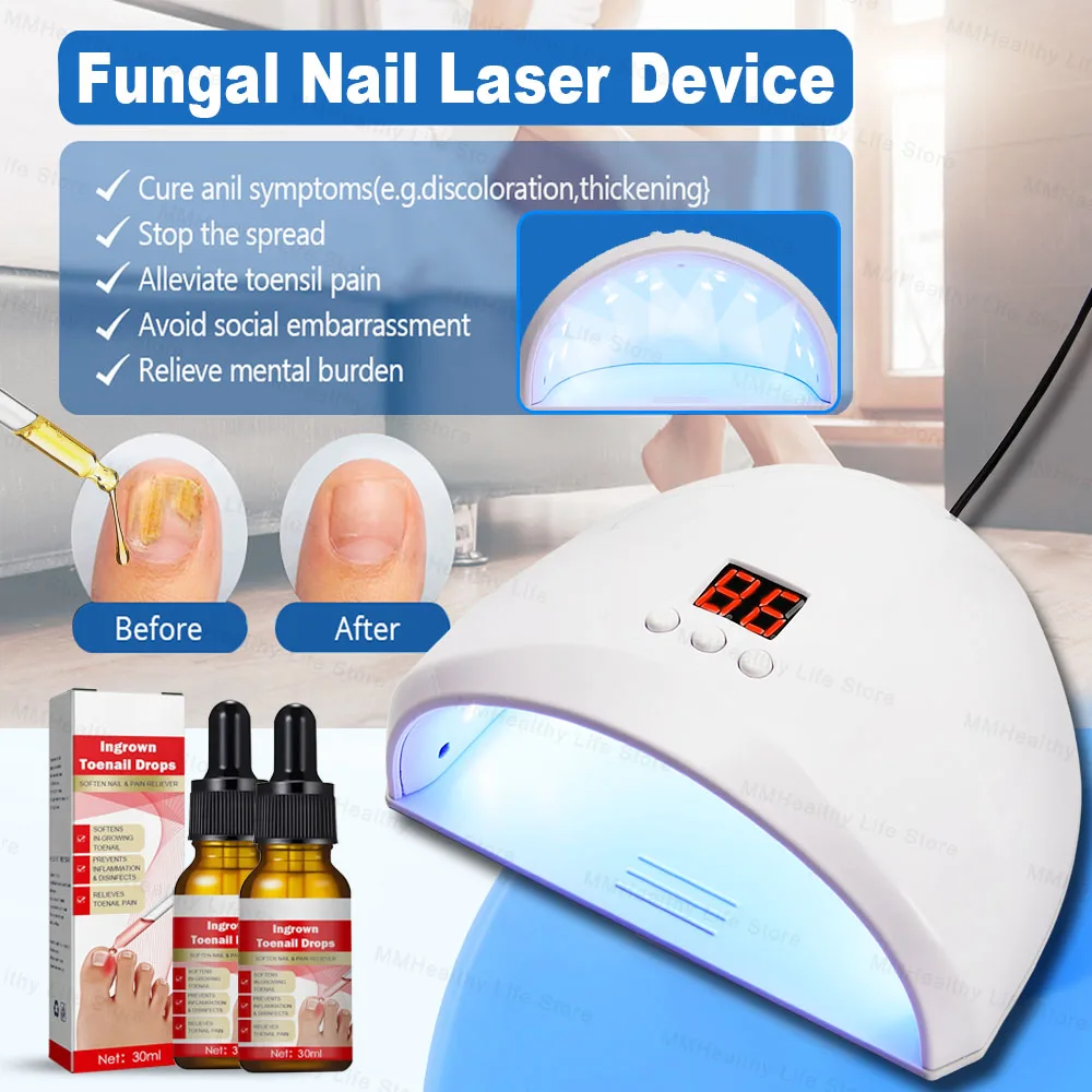 Fungal Nail Laser Device Fast Repair Essence Oil for Toenail Fingernail Treatment Onychomycosis