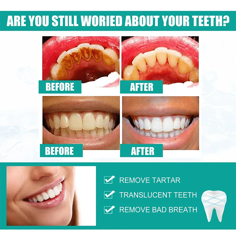 Dental Calculus Remover Teeth Whitening Spray Toothpaste Cleaning Oral Hygiene Removal Halitosis Plaque Stains Fresh Breath Care teeth whitening product teeth whitening essence dental calculus remover teeth health product