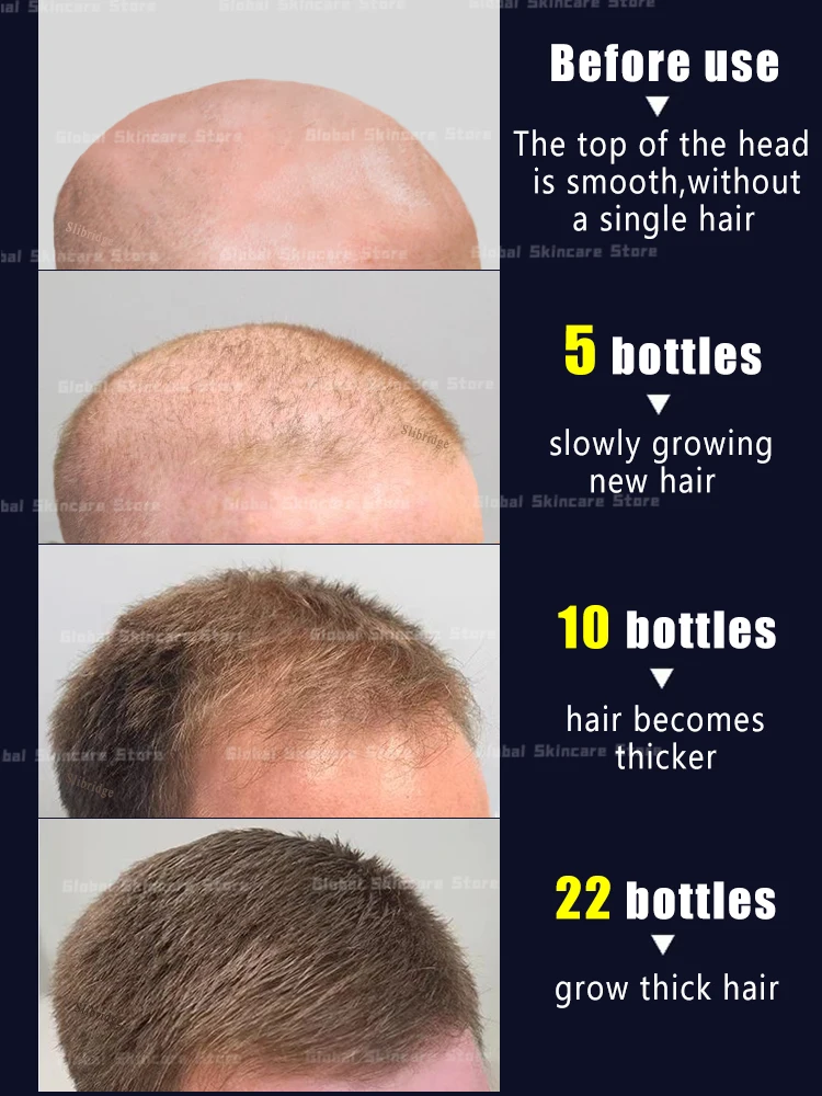 Hair Growth Essential Oils Hair growth essential oils that can make hair grow anywhere