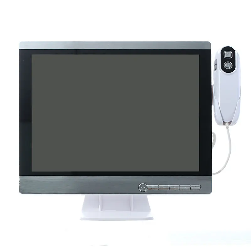High Quality 15.5 Inch Scalp Detector Hair Test Analyzer Microscopic Skin Scalp And Hair Camera / Microscope Camera