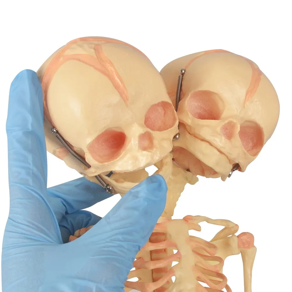 Human Double Head Baby Skull Model Skeleton Anatomy Medical Science Display Study Teaching Model