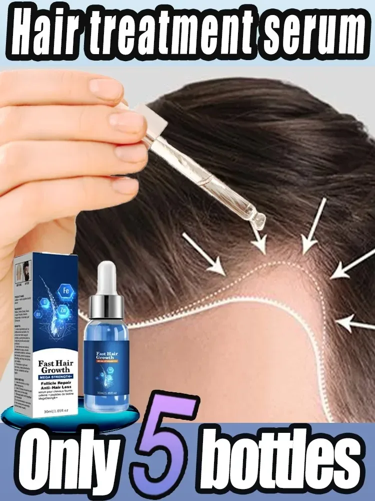 

Fast Hair Growth Oil Effective Baldness Repair Hereditary Postpartum Seborrheic Hair Anti Loss