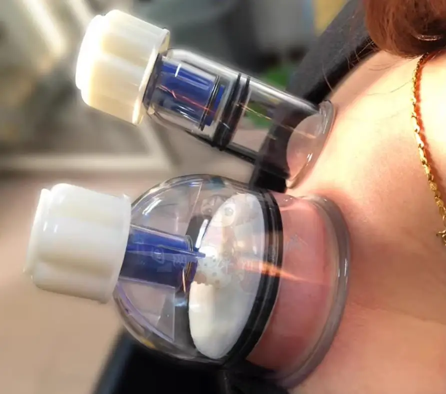 6 thickening cupping jar of hand twist type magnetic therapy rotary pump tanks tanks