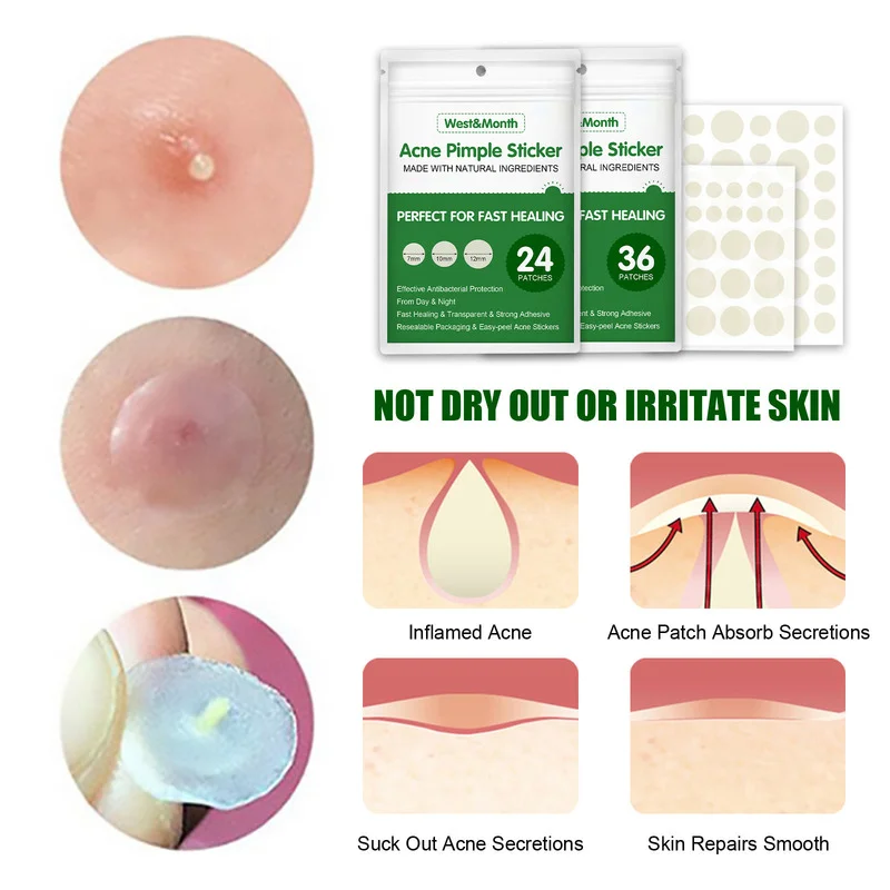 Acne ingredientes naturais espinha adesivo hidrocolóide remendo rosto acne removedor tratamento mancha mancha cuidados com a pele_voghion.com