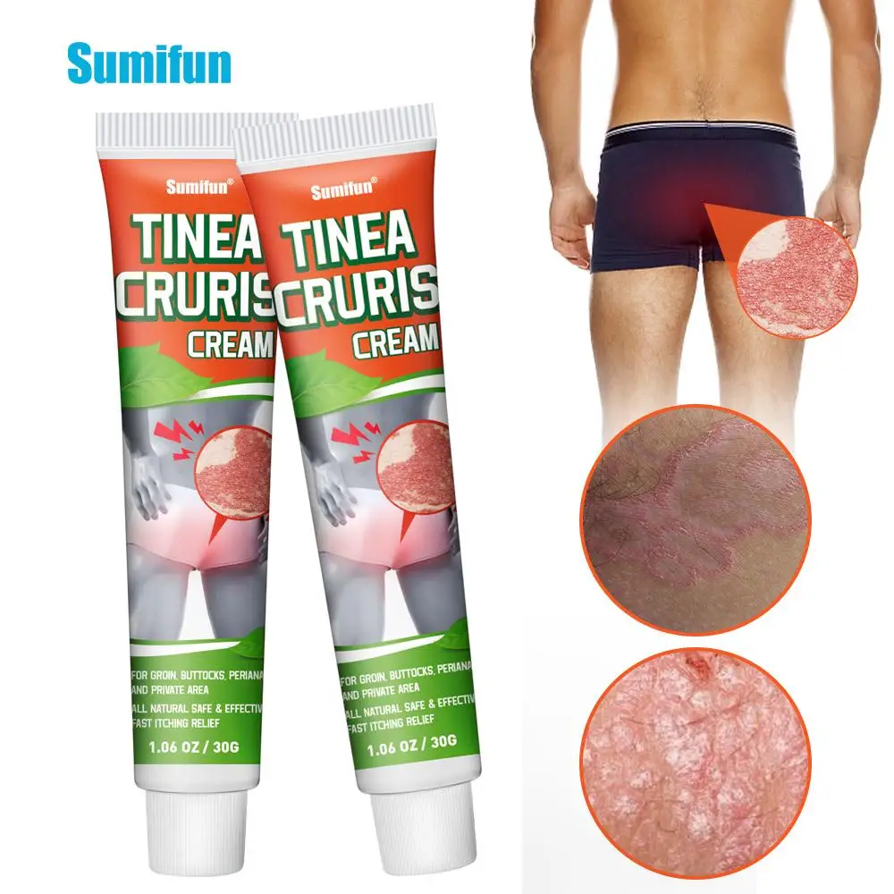 

2PCS Sumifun 30g Tinea Cruris Psoriasis Skin Medical Plaster Psoriasis Cream Treat Eczema Dermatitis Tinea Cruris Beriberi Ointm