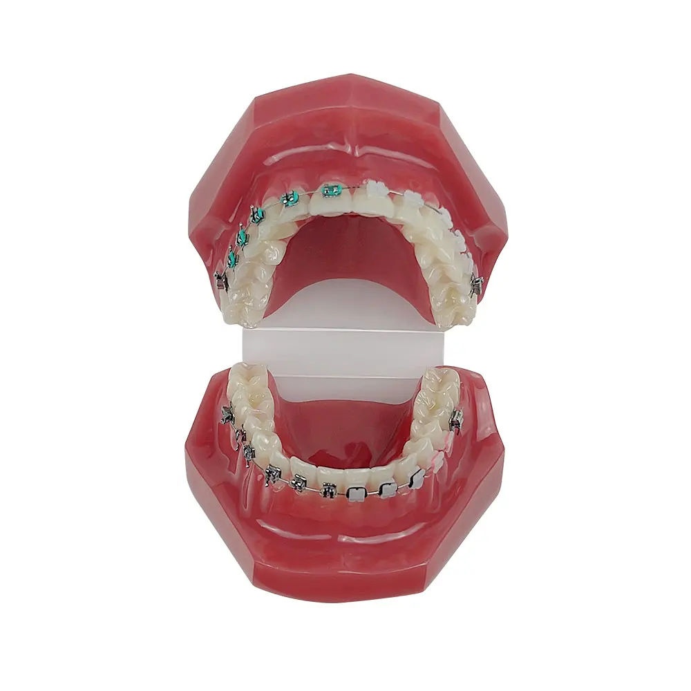 Orthodontic Dental Treatment Teeth Model Teaching Study Gum Tooth Models With Ortho Metal Bracket Arch Wire Ligature Ties Dentis images - 6