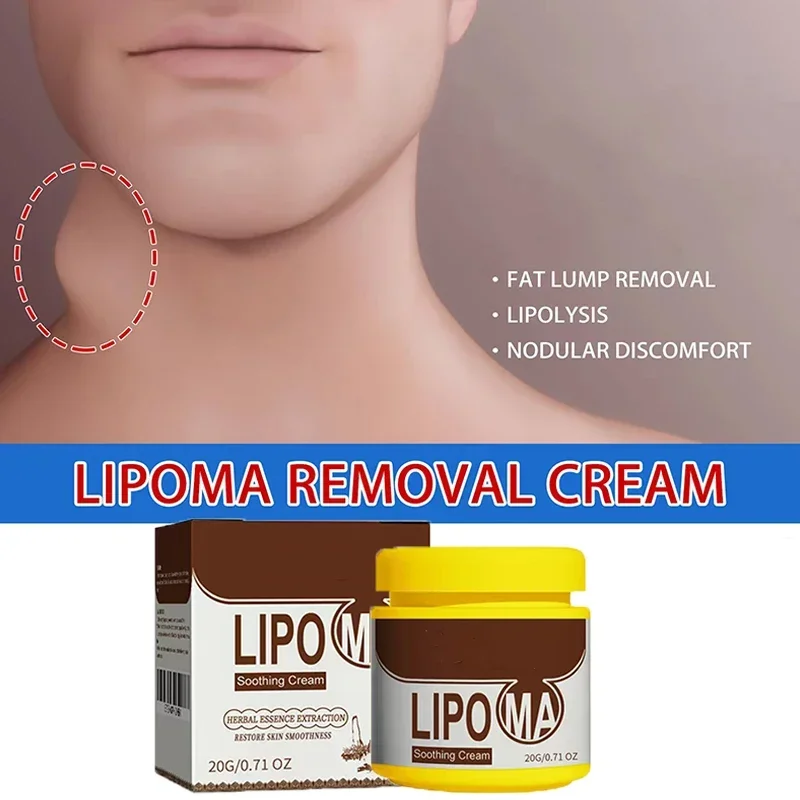 Soothing Cream Subcutaneous Lumps Remover cream lumps remover
