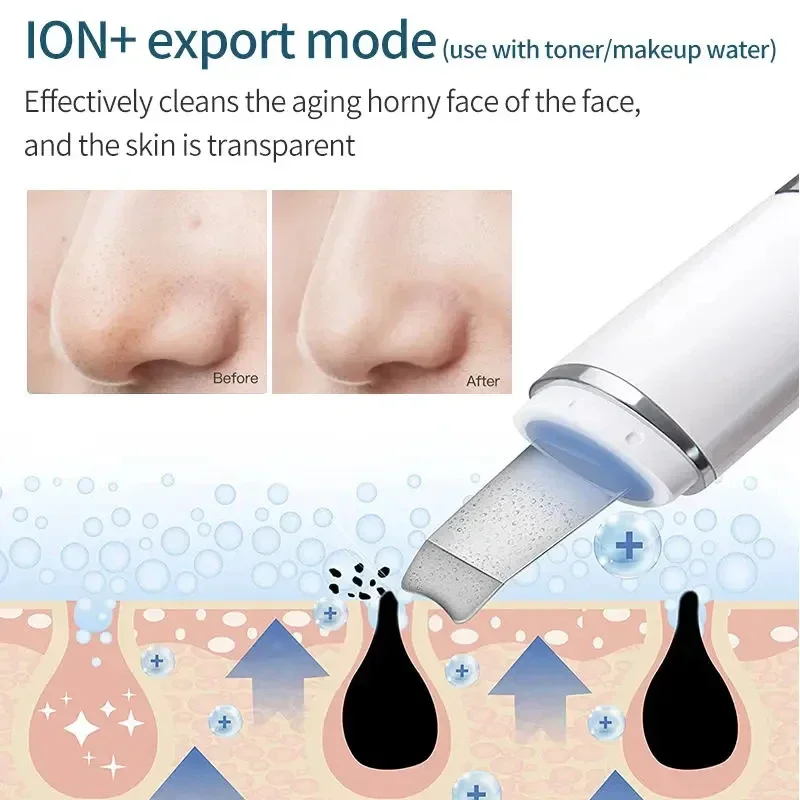 Skin Scrub Facial Scraper, Facial Scraper, For Deep Cleansing Skin 4 in 1 Pore Extractor with USB Charger