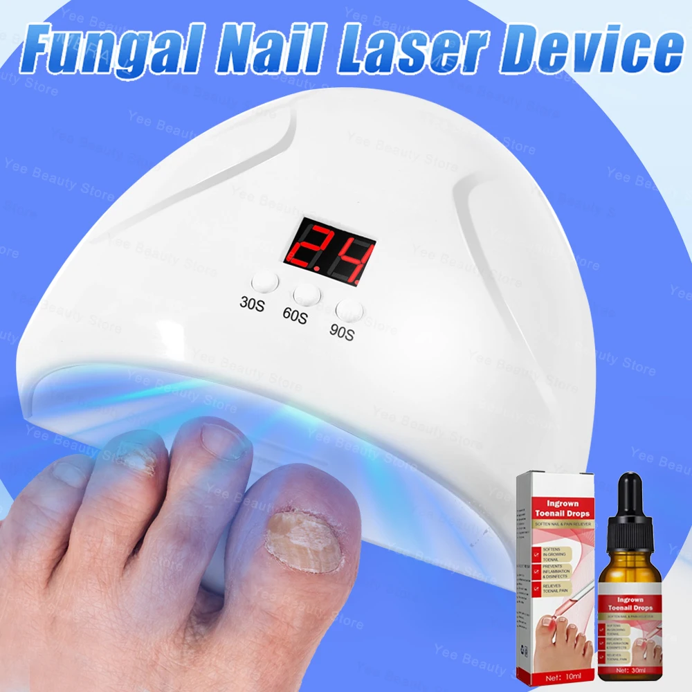 Fungal Nail Laser Device Repair Toenail Fingernail Treatment