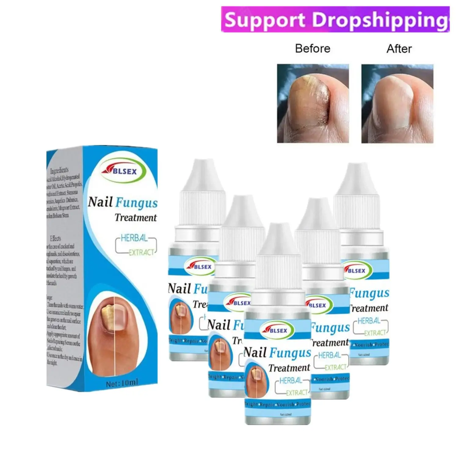 

5X Fungus Nails Treatment For Fingernails Toenails Repair Onychomycosis Paronychia Anti Infection Toe Nail Fungal Removal Liquid