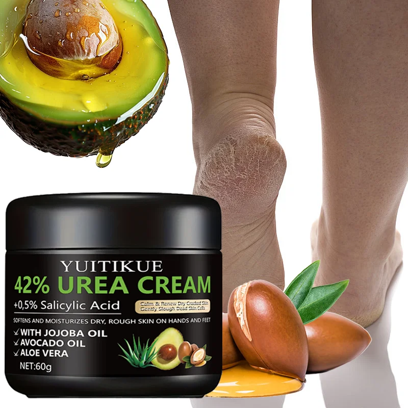YUITIKUE 42% urea cream, 0.5% salicylic acid, softens and moisturizes dry and rough skin on hands and feet