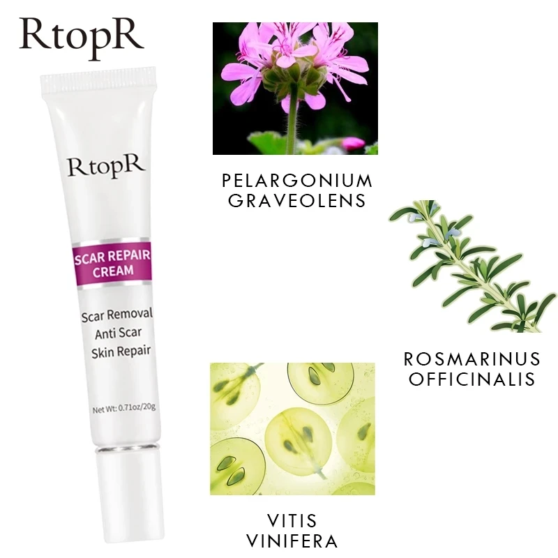 RTOPR Acne Scar Stretch Marks Remover Cream Skin Repair Face Cream Acne Spots Treatment Blackhead Whitening 20g
