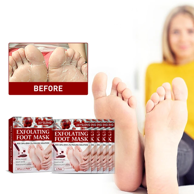 2Pair Honey Foot Mask Foot Dead Skin Remover Exfoliating Foot Cream For  Heels Whitening Anti Cracked Foot Spa Skin Care Tool - AliExpress