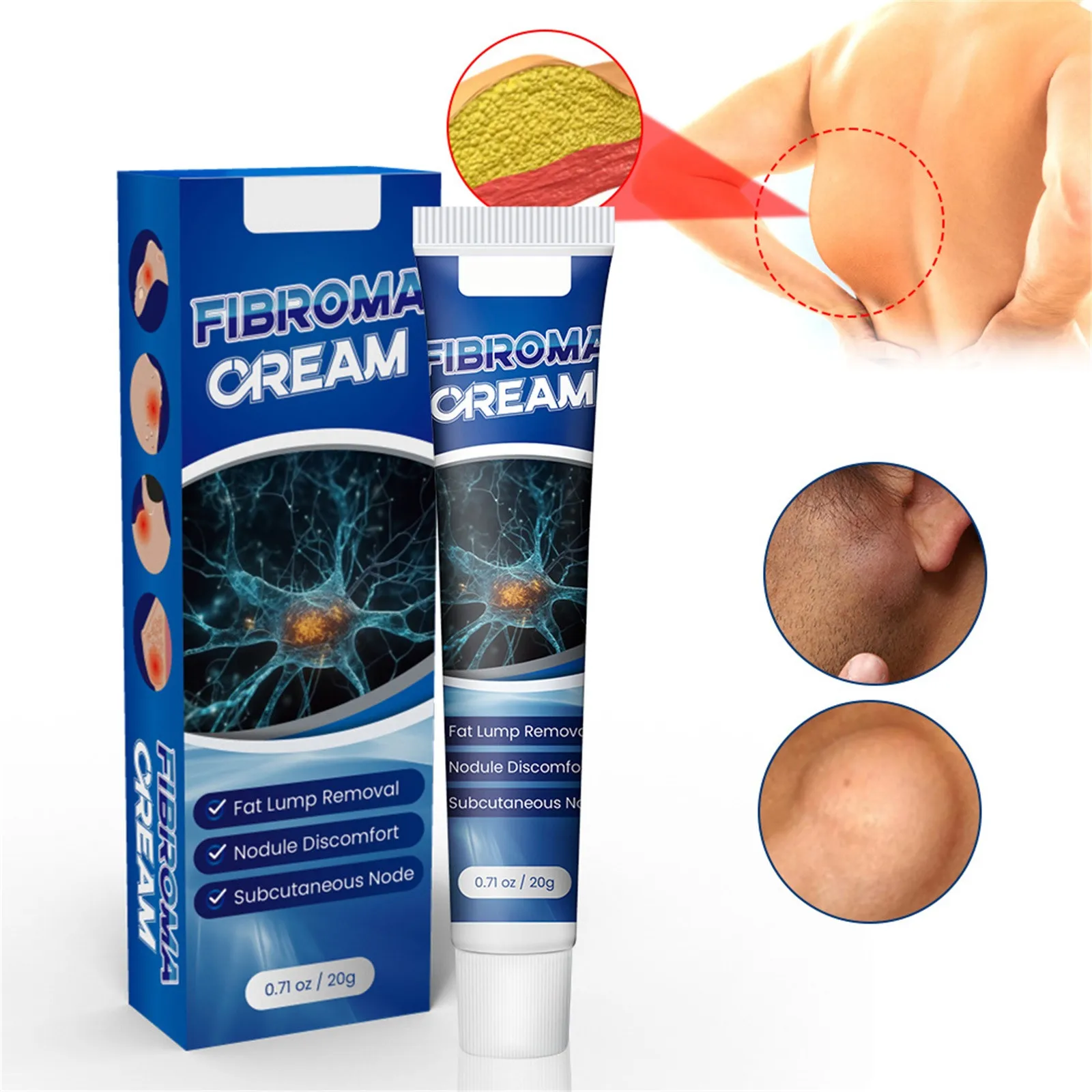 Reduce Lipoma Gel In Organic Material Fast Absorption Reduction Of Inflammation Moisturizing Effect skin care products lipoma removal ointment