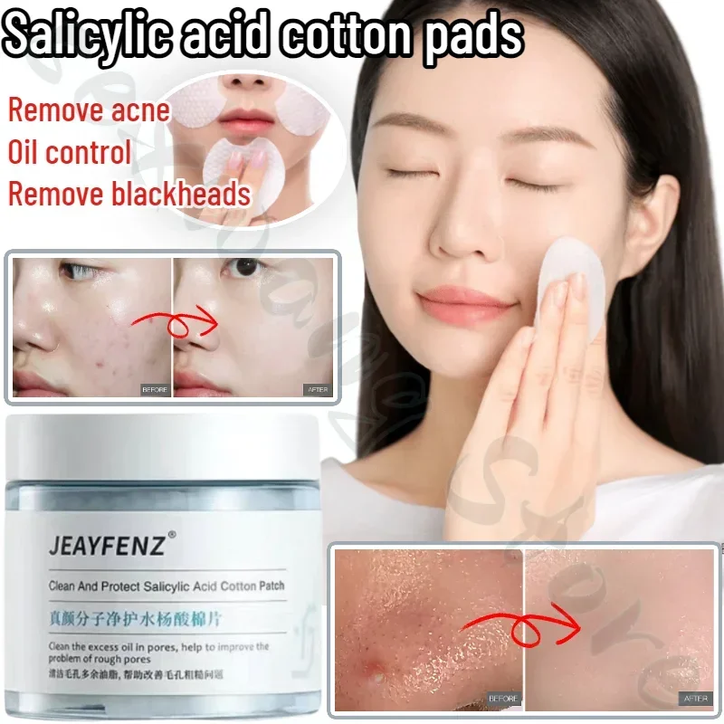JEAYFENZ Salicylic Acid Cotton Tablets Smooth Closed Mouth, Dissolve Blackheads, Acne, Acne, Gentle for Men and Women 60 Tablets women classic anti bacteria surgical medical shoes safety closed toe mule clogs slippers cleanroom work slides for women
