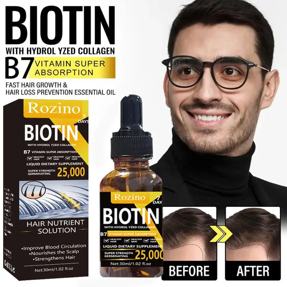 

Быстрое масло для роста волос, сыворотка против выпадения волос, предотвращение повреждения волос, уход за кожей головы, Эфирное средство для бороды, сухая лечение облысения M8F2