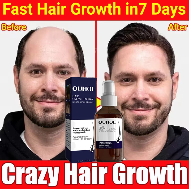 

Hair Growth Spray Fast Growing Prevent Hair Loss Essential Oil Treatment Consolidating Nourish Roots Hair Health Repair Products