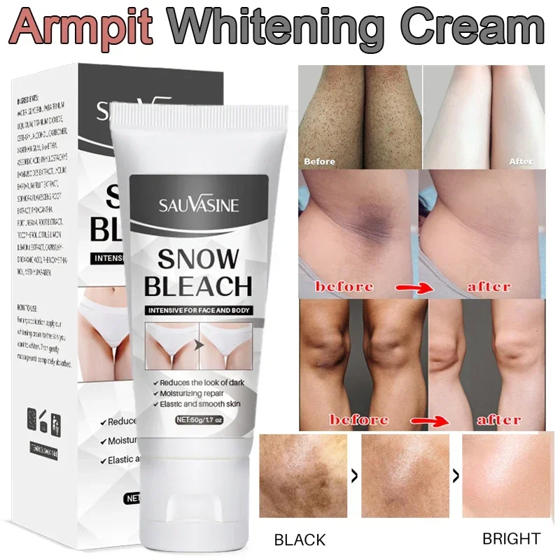 50gWhiteningCreamBleachBodyBleachingFreckleRemovalCreamLegs