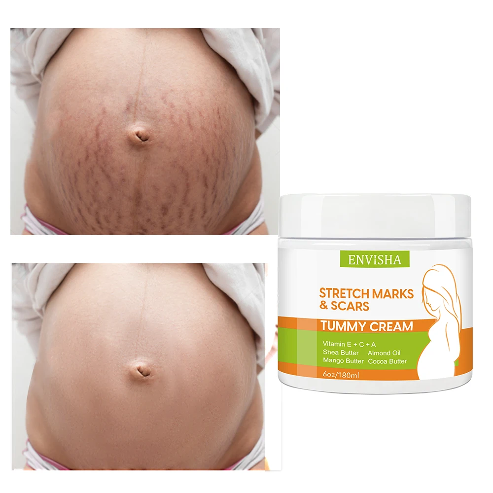 

ENVISHA Remove Stretch Marks Cream Maternity Body Care Scar Anti-aging Wrinkle Skin Postpartum Pregnant Women Repair Firming