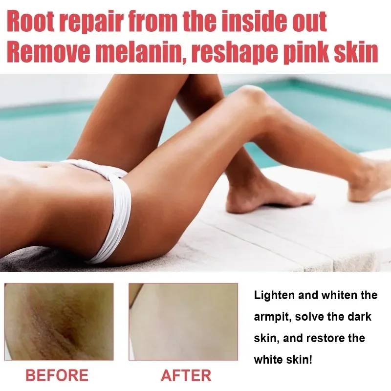 

Sdatter Body Whitening Serum Intimate Areas Thigh Inner Joint Dark Melanin Remove Underarm Knee Lip Bleach Private Part Brighten