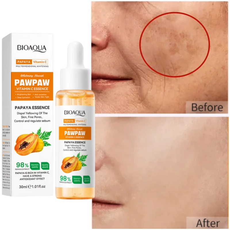 Whiten Freckle Papaya Serum Effective Remove Freckle  Fade Melasma Dark Spots Melanin Whiten Brighten Korea Skin Care Products