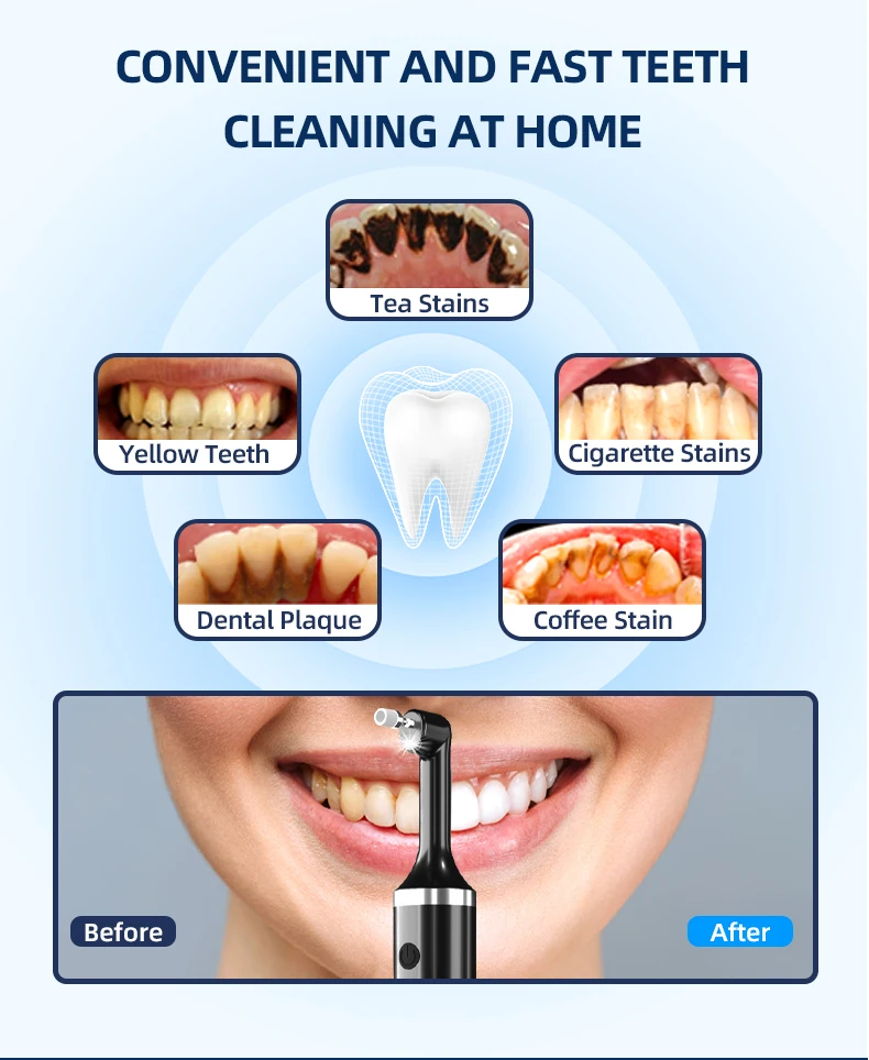 Description Picture 4 of itemTooth Polisher Teeth Cleaning with 5 Cleaning Modes Removes Tartar and Dental Calculus Electric Tartar Polishing Kit Tooth Clean
