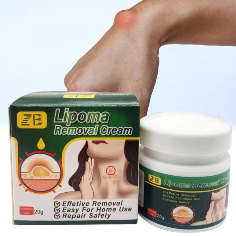 Skin Care Ointment 20g Herbal Lipoma Removal Cream Lipolysis Skin Swelling Cellulite Treatment