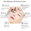 Protein Thread Lifting Set Face Filler Absorbable Collagen Protein Thread Firming Anti-aging Smoothing Firming Moisturizing 3
