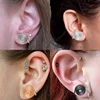 for Swelling Pressure Earrings Non Piercing Earrings Stainless Steel Keloid Pressure Earrings Black Color Jewelry Accessories 2